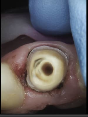 Ravo 21 tk7sbt - Eugenol