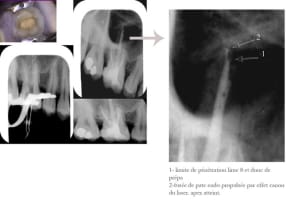 Recap zhoflv - Eugenol