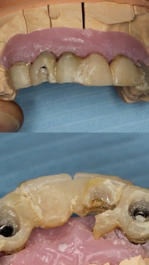 Rescellement fyu4dt - Eugenol