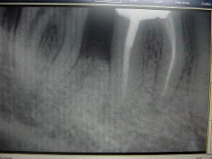 Retro0301 aj0l1f - Eugenol