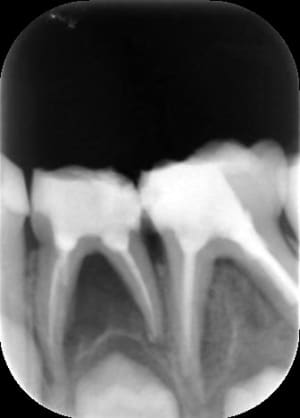 Retro opfivk - Eugenol