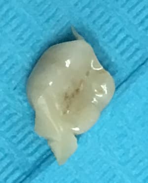 Rh56dk7mlvrhxpet38d2 - Eugenol