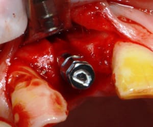 Rugb960kluv2cki41e5jm2qzkf3y - Eugenol