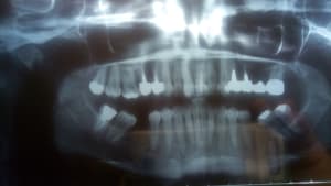 S5rh6wgud7a821idwsws - Eugenol