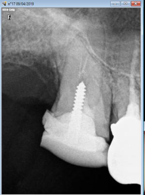 Sc 33 17 qskygy - Eugenol