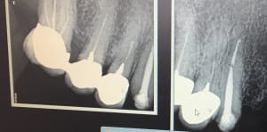 Sect1 bagbbt - Eugenol