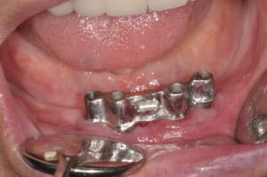Sept2012 xsqtqg - Eugenol