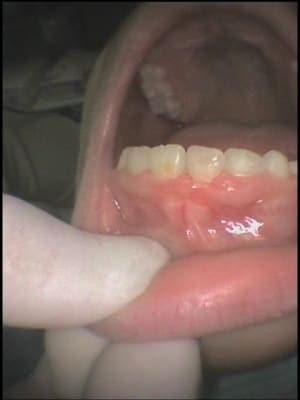 Sophie inc inf fpdvko - Eugenol