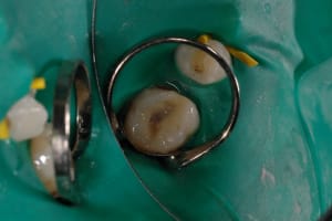 Strat1 m8lqi9 - Eugenol
