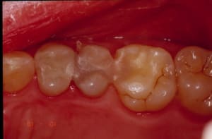 Systemp ishngx - Eugenol