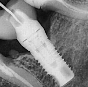 T0p2e93qbqthh57ryb7yu48cqbmr - Eugenol