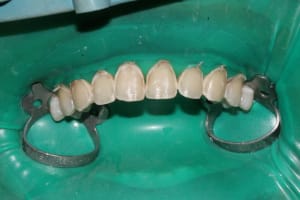 Taille digue1 m1boqx - Eugenol