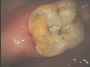 Tarc1 yvrru3 - Eugenol