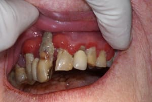 Tartre5 xszluq - Eugenol