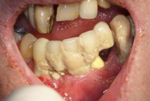 Tartre6 pzxifu - Eugenol