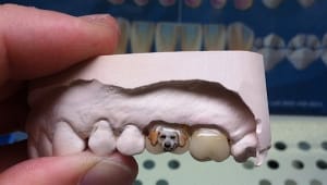 Tatooth tendance tatouage dentaire ysbknb - Eugenol