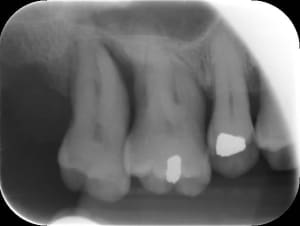 Tom 17 zgje7f - Eugenol