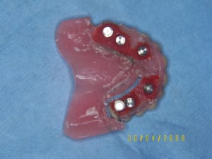 Transfo complet b5ygir - Eugenol