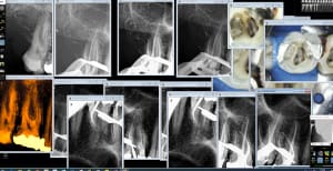 Turp endo 17 16 osaxwp - Eugenol