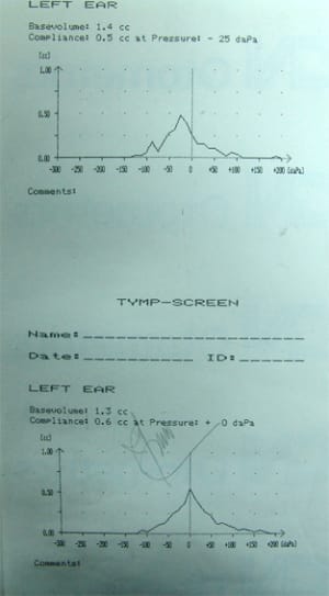 Tymp2 dihwy5 - Eugenol