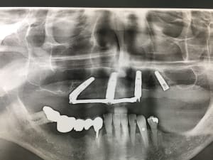 U4wqthdfilr3sqtej2vn - Eugenol