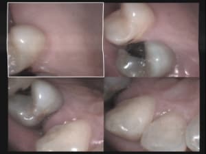 Un cas difficile paro à 15 jours 1 ghlqzg - Eugenol