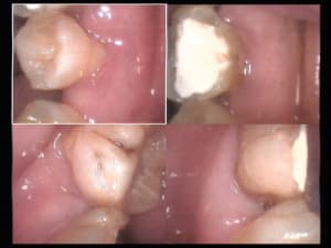 Un cas difficile paro à 90 jours 6 l3zdq5 - Eugenol
