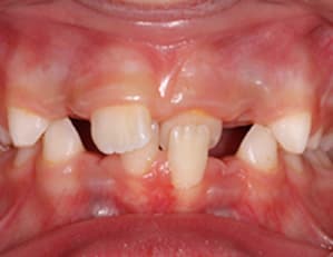 Unedublog p80lox - Eugenol