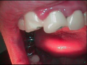 Urgence  vtt aikuot - Eugenol