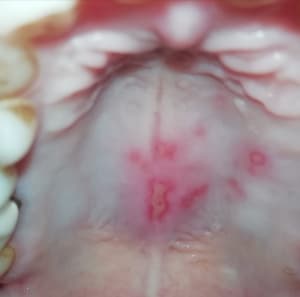 Vft2gj2jnrwnzzwzmeqf - Eugenol