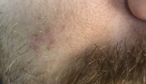 Vv2vaktzkyto3mo7xvyu - Eugenol