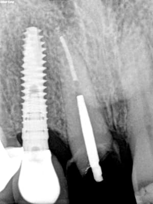 Vxhvmdx721209wnhmu4j0w1p5abs - Eugenol