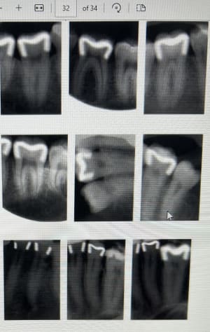 W52ta052ohlf2l5ntide2qdl9ggs - Eugenol