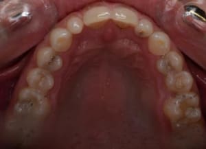 Wasxlyxgv0q4h2qemw1z - Eugenol