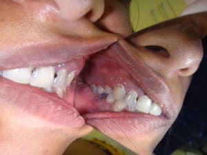 Wgvhyqhm2cdezdqpjpvm - Eugenol