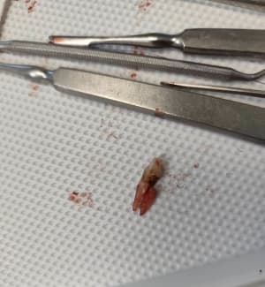 Wry8g18wly7bm3akkzvhepfktjq6 - Eugenol