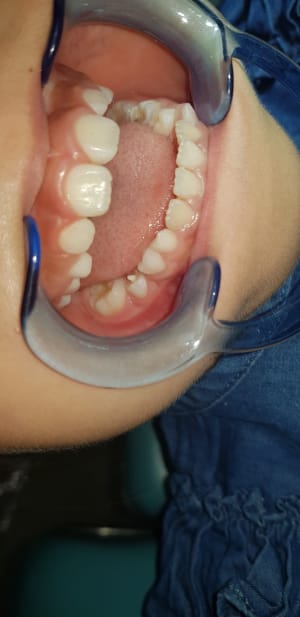 Xfz7zpz0kgpq3khtw0pj - Eugenol