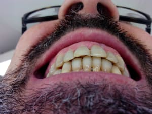 Xsmk2m64f7gnn1uhp4ky - Eugenol