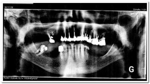 Y37lx30oefpctgqxdit90yfwspbm - Eugenol