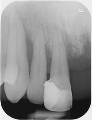 Yfhrmshdnlh9plclovfb - Eugenol