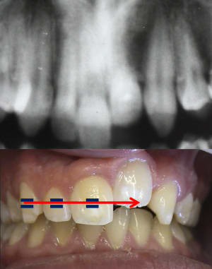 Ynkmdvmtx6l97aqkj5msy0pyvx51 - Eugenol