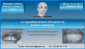 Ypi5ky1fv2rdap0khhdt - Eugenol