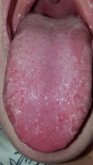 Zuoadr2uvd18laimkcsi - Eugenol