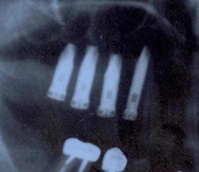 Çradios 2 pp9iwa - Eugenol