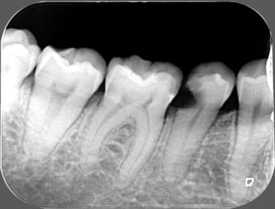 00048 x 2011 07 21 15 50 12 4 qhw4yk - Eugenol