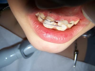 000 0105 ltw7ko - Eugenol