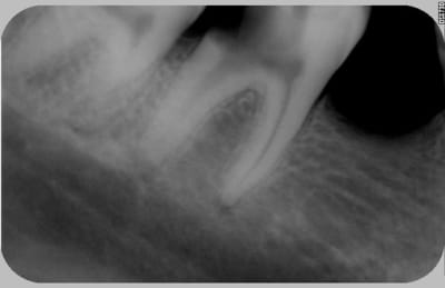 001 btxbyo - Eugenol