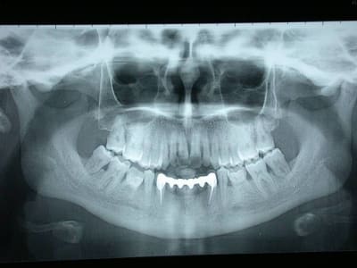 001 qy88kt - Eugenol