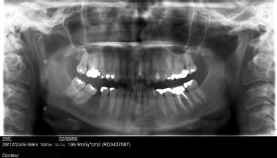 001 vmsw3m - Eugenol