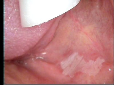 002 avkptc - Eugenol